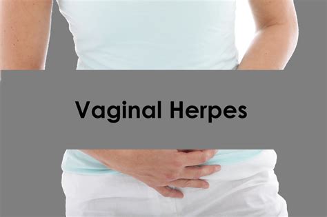 herpee|herpes in women.